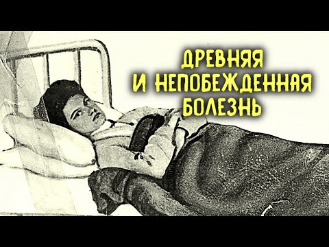 Видео: Кто такая Тифозная Мэри и откуда взялись "проверки на вшивость"