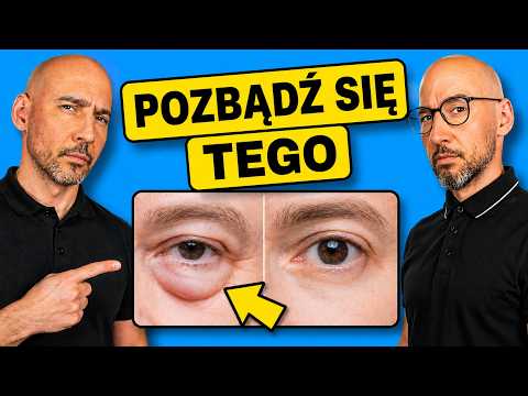 This Is How To Get Rid Of Puffy Eyes For Good!