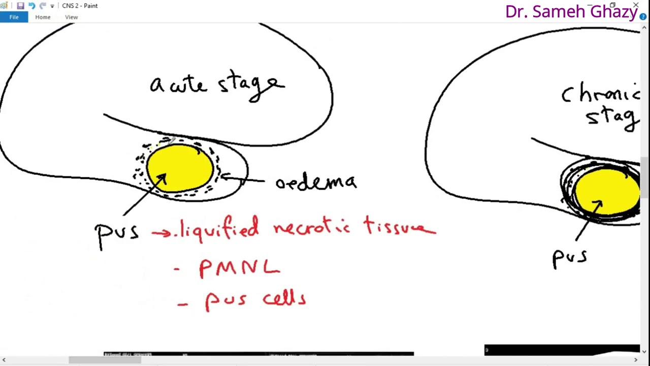 Systemic pathology 18 : CNS 2   (brain abscess and degenerations ) DR.SAMEH GHAZY