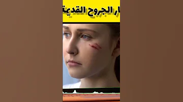 علاج آثار الجروح القديمة والتخلص منها الدكتور عماد ميزاب Docteur Imad Mizab 