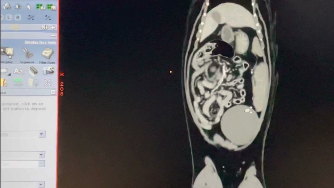 Kedilerde batın tomografi incelemesi