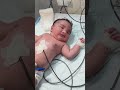 new baby🥰 in nicu#newbornbaby #youtubeshorts