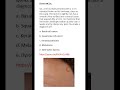 Medicine & Surgery MCQs (For MBBS, USMLE, MCCQE & PLAB)