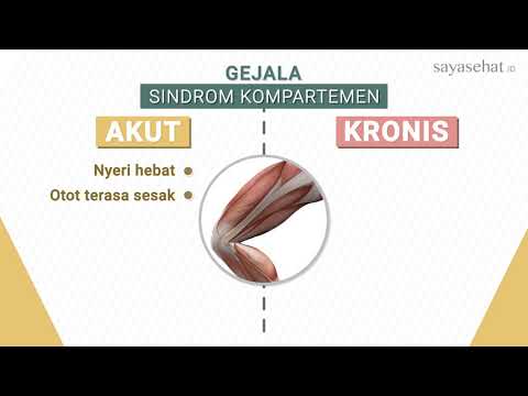 Video: Sindrom Kompartemen: Sebab, Jenis, Dan Gejala