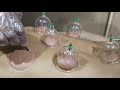 Cupping Therapy|Hijama Cuts