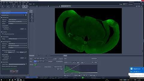 Automated Confocal Imaging of Whole Mouse Brain