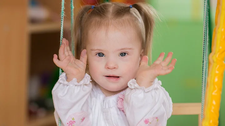 Welcoming a Baby that is Different - Teaser