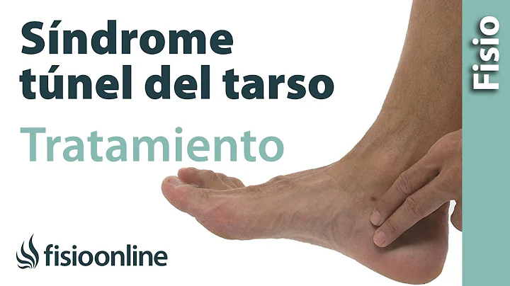Qué es el Síndrome del túnel del tarso y cuál es su tratamiento.