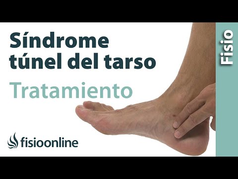 Vídeo: Síndrome De La Almohadilla Del Talón: Síntomas, Causas, Tratamiento