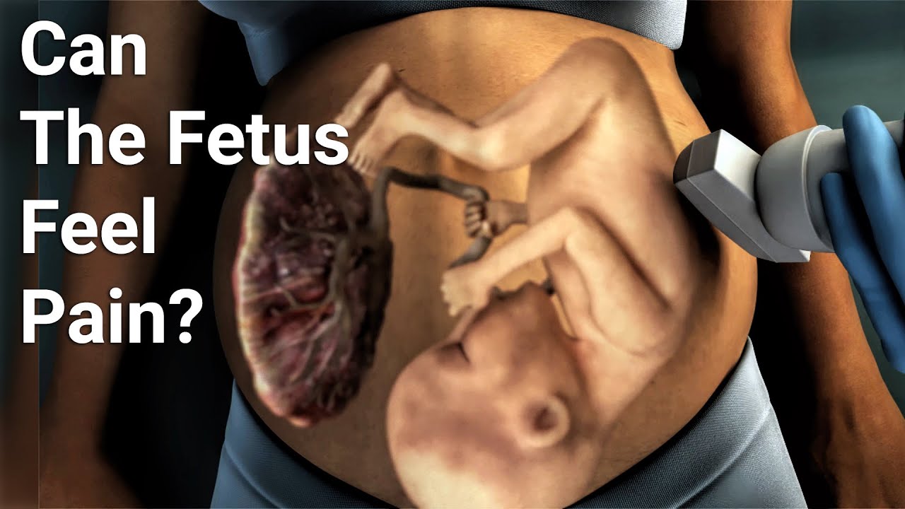 Do Fetuses Sleep At 10 Weeks Do Fetuses Sleep At 10 Weeks