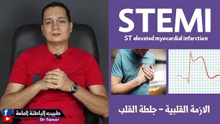 STEMI (st elevated myocardial infacrtion) / الأزمة القلبية وجلطة القلب من النوع STEMI