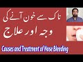 Nakseer ya naak se khoon ane ki waja aur ilaj / how to stop Nose bleeding or Epistaxis in Urdu