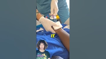 How to remove a PICC line in nursing #shorts