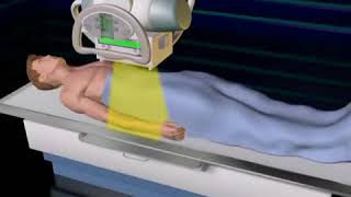 IGCSE CS Input Devices - 3D scanners