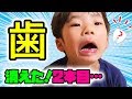 【育児日記】2本目の抜歯！でも…その乳歯が消えました…。どうやって抜けた？【えにしくん5歳児