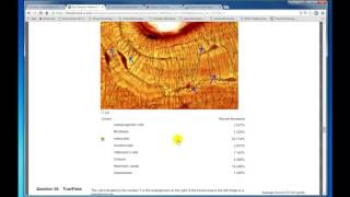 Famous Module 2 Quiz Part A VideoReview Wealth