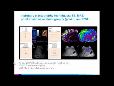 Imaging of Liver Fibrosis and Cirrhosis