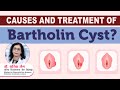 Causes and treatment of bartholin cyst  dr sarita jain  arihant ivf