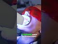 Snow Teeth Whitening: Competitor Comparison Strategy