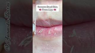 Remove Dead Skin From Lips 👄/Dry Lips Home Remedy 💯 #shorts #skincare #lipcare #youtubeshorts #viral