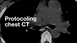 Protocoling chest CTs