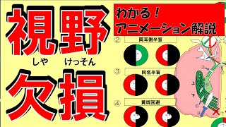 視野欠損について　20211222