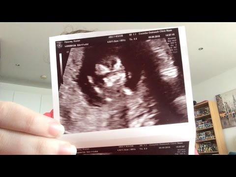 DATING ULTRASOUND ANXIETY! ARE THERE 1 OR 2 IN THERE?? (DAY 99) from YouTube · Duration: 14 minutes 43 seconds DATING ULTRASOUND ANXIETY! ARE THERE 1 OR 2 IN THERE?? (DAY 99) from YouTube · Duration: 14 minutes 43 seconds