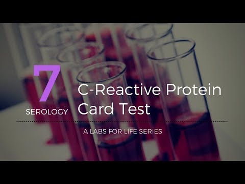 C Reactive Protein Card Test