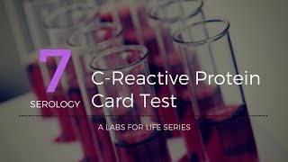 C-Reactive Protein (CRP) | Inflammation | Acute phase reactant