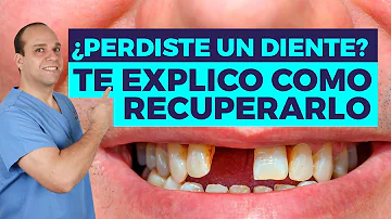 ¿Qué puede hacer un dentista si no tienes dientes?