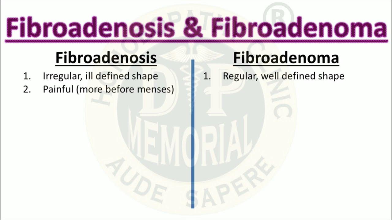 Difference Between Fibroadenosis And Fibroadenoma Youtube