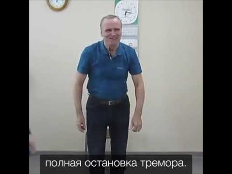 Действие dbs-стимулятора при болезни Паркинсона