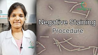 Negative Staining Microbiology।Staining Procedure।Negative Staining Bacteria