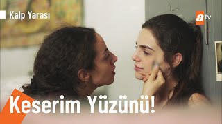 Ayşe'ye koğuşta saldırı! - @KalpYarasiatv 13. Bölüm