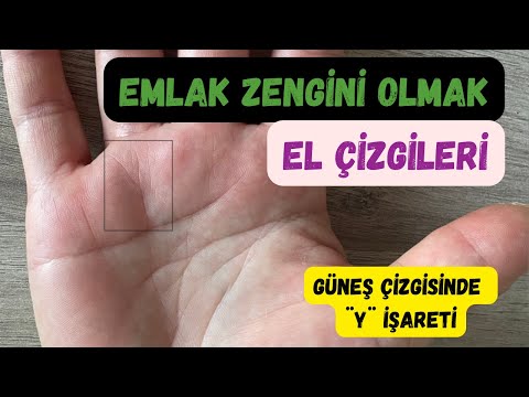 Emlak Zengini Olmak - Güneş Çizgisinde ¨Y¨ İşaretinin Anlamı - El Çizgileri