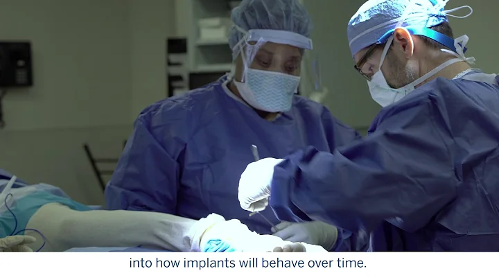 Overcoming Challenges in Total Ankle Replacement (:18)