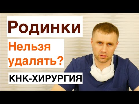 Родинки. Какие нельзя удалять?