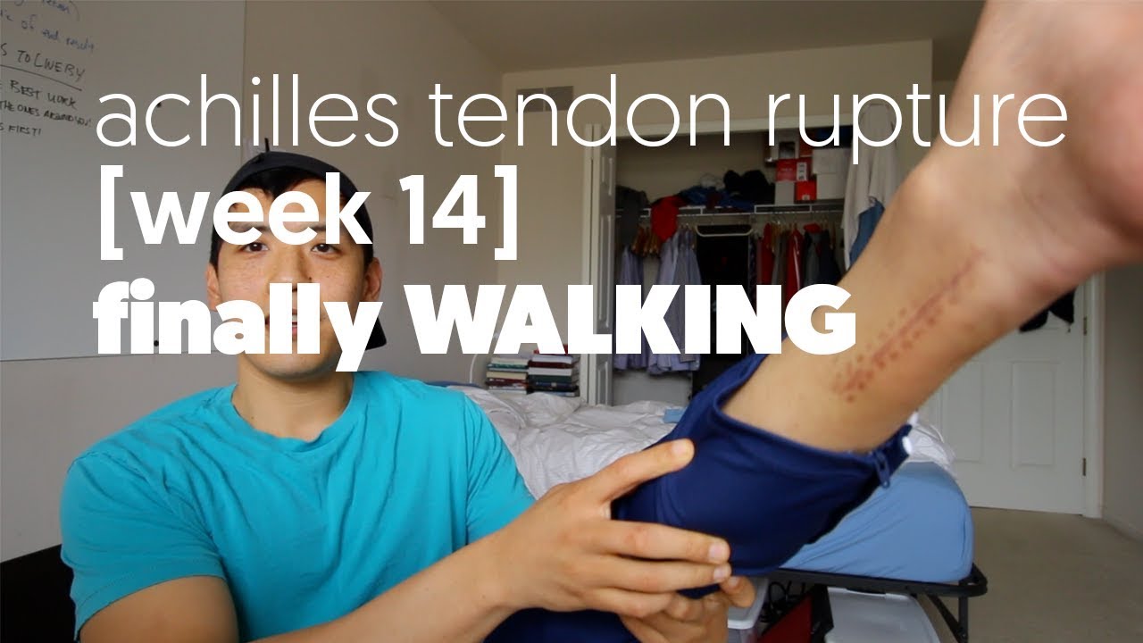 Achilles Tendon Rupture Week 14 Finally WALKING YouTube