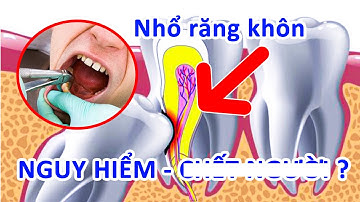 Nhổ Răng Khôn Có Nguy Hiểm Không?
