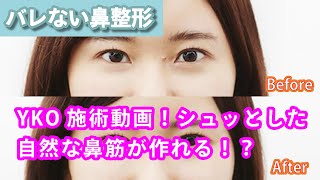 【Y-KO(ワイコ)】鼻の悩み解決！バレない鼻整形術！