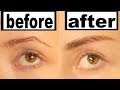 DIY EYEBROW LIFT!