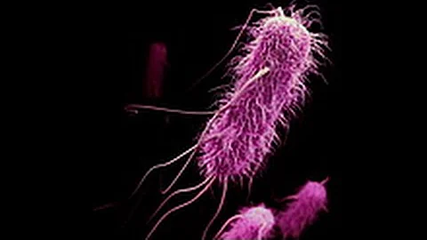 Antibiotic Resistance | Are we creating super bacteria?