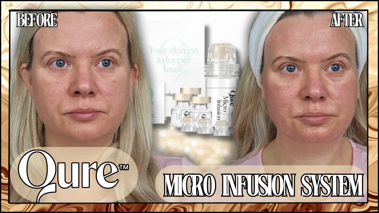 QURE MICROINFUSION SYSTEM Full Demo & Review *MICRONEEDLING AT HOME* Clare Walch YouTube