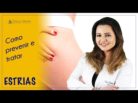 Estrias: como prevenir e tratar - Dra. Renata Sitonio