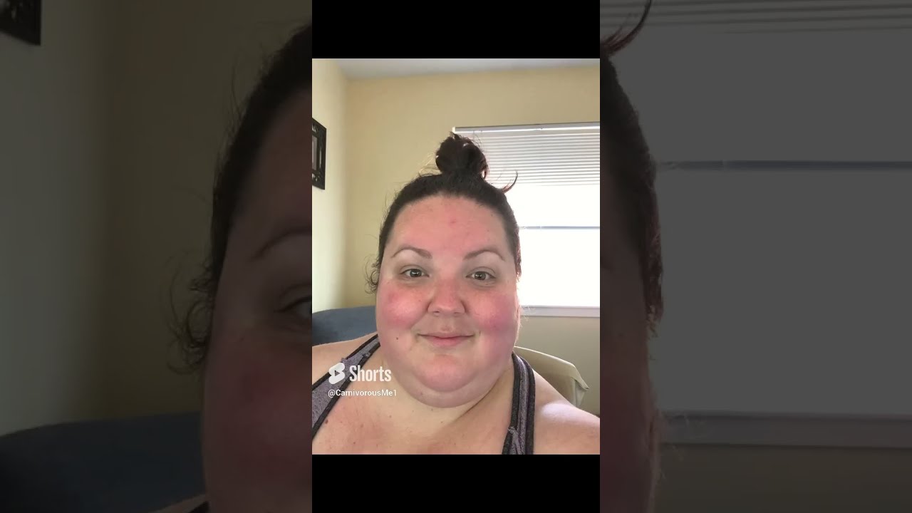 My 116 Lbs 10 Month Weight Loss Transformation Health Weightloss Carnivore