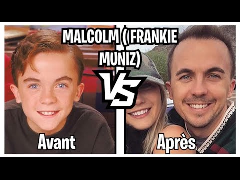 AVANT APRES LES ACTEURS DE MALCOM 2021