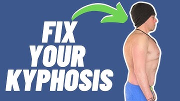 Correcting Rounded Shoulders: Proven Methods to Fix Posture Permanently
