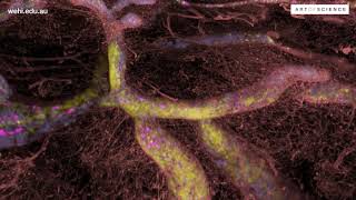 Breast cancer exploration by Caleb Dawson | Art of Science