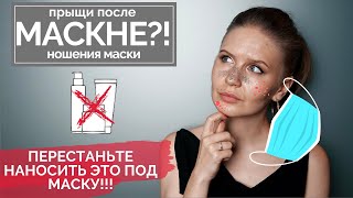 МАСКНЕ прыщи на подбородке и щеках после ношения маски