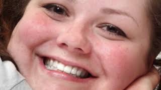 Gojaznost I Pubertet